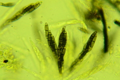 Chaetosphaerella phaeostroma