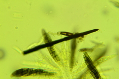 Chaetosphaerella phaeostroma