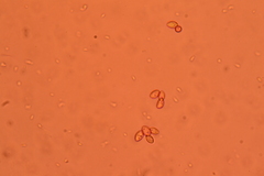 Crepidotus subverrucisporus
