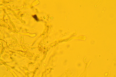 Punctularia strigosozonata