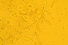 Punctularia strigosozonata