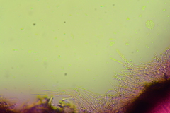 Coccomyces
