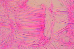 Coccomyces