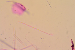 Coccomyces