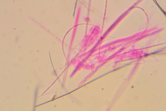 Coccomyces
