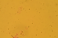 Collybiopsis