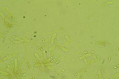 Glabrocyphella ohiensis