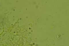 Glabrocyphella ohiensis