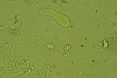 Glabrocyphella ohiensis