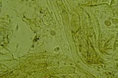 Glabrocyphella ohiensis