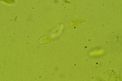 Calyptella