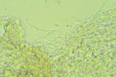 Calyptella