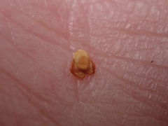 Semudobia betulae