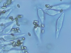 Macrocystidia