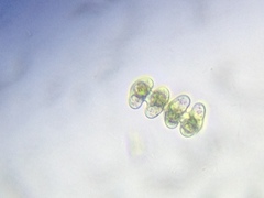 Staurastrum striolatum