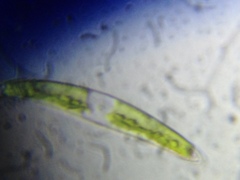 Closterium leibleinii