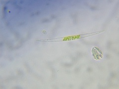 Closterium turgidum