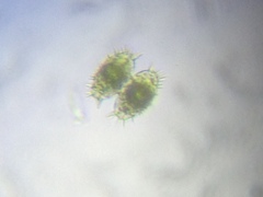 Staurastrum polytrichum