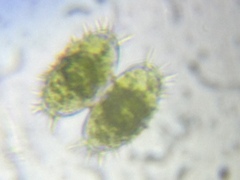 Staurastrum polytrichum