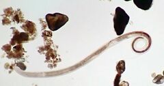 Nematoda