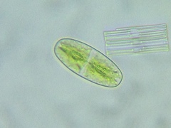 Netrium digitus