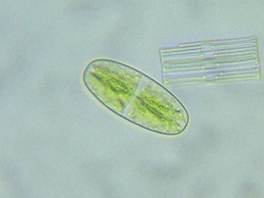 Netrium digitus