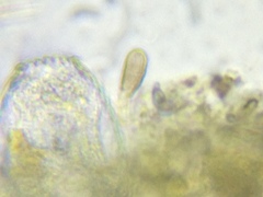 Argynnia dentistoma