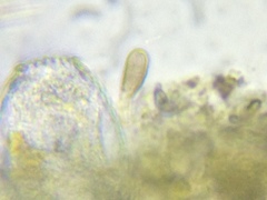 Argynnia dentistoma