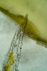 Racomitrium canescens latifolium