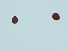 Setulosi