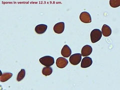 Setulosi