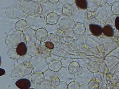 Setulosi