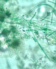 Cyanobacteria