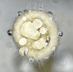 Poronia erici