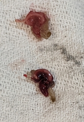 Lernaeocera branchialis