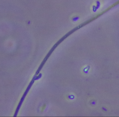 Bacteria