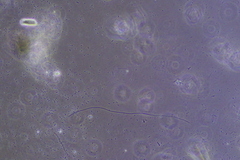 Bacteria
