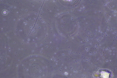 Bacteria