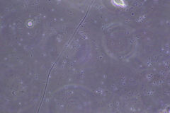 Bacteria