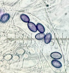 Ascobolus aglaosporus