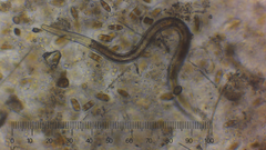 Nematoda