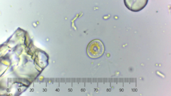 Cocconeis