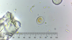 Cocconeis
