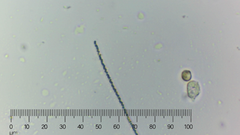 Bacteria