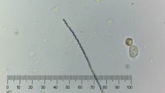 Bacteria