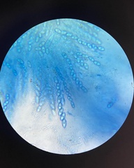 Hydropisphaera peziza