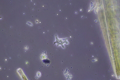 Amoebozoa