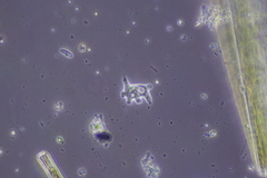 Amoebozoa