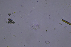 Amoebozoa