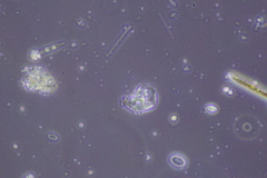 Amoebozoa